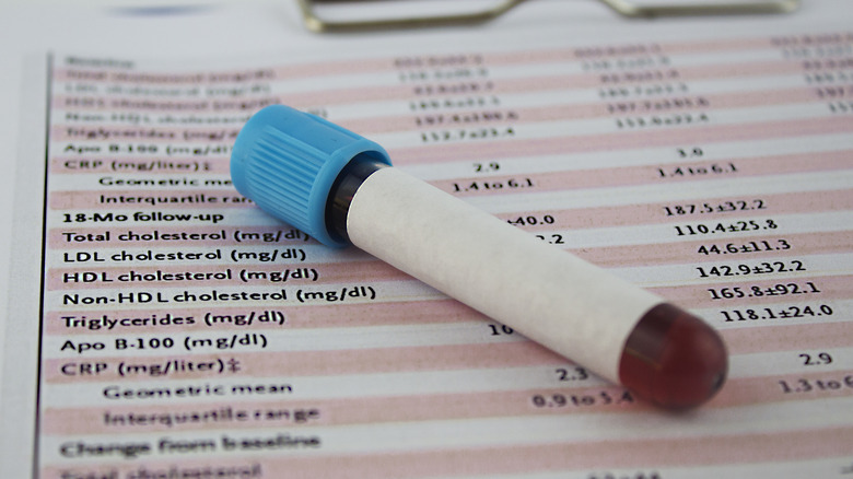cholesterol test results and vial of blood
